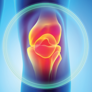 Abstract image of painful knee